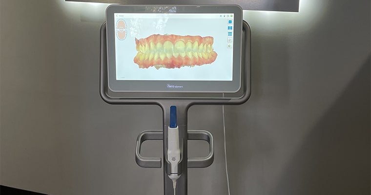 iTero scanner at The Dental Market used for smile design procedures