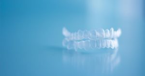 Top and bottom clear aligners on a blue table